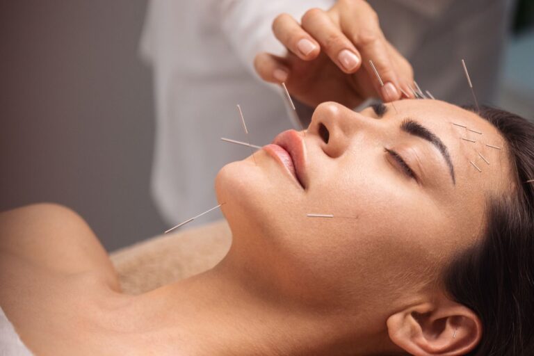 Exploring the Connection Between Acupuncture and Vagus Nerve